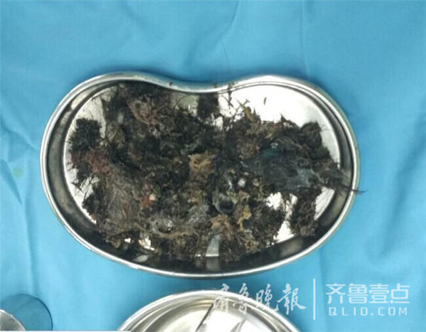 5�qŮͯ��͵���^�l θ��ȡ������ë�l�Yʯ